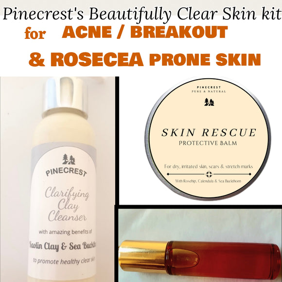 Beautifully CLEAR SKIN  kit ( ACNE / breakout & ROSECEA prone skin)